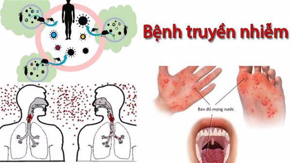 Tăng cường triển khai các hoạt động phòng, chống các bệnh truyền nhiễm nguy hiểm