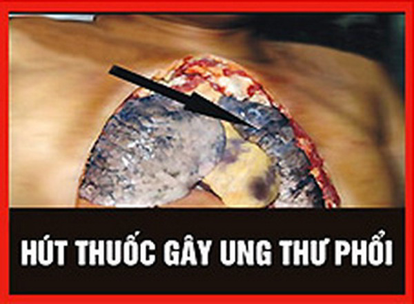 Thông tư liên tịch hướng dẫn việc ghi nhãn, in cảnh báo sức khỏe trên bao bì thuốc lá